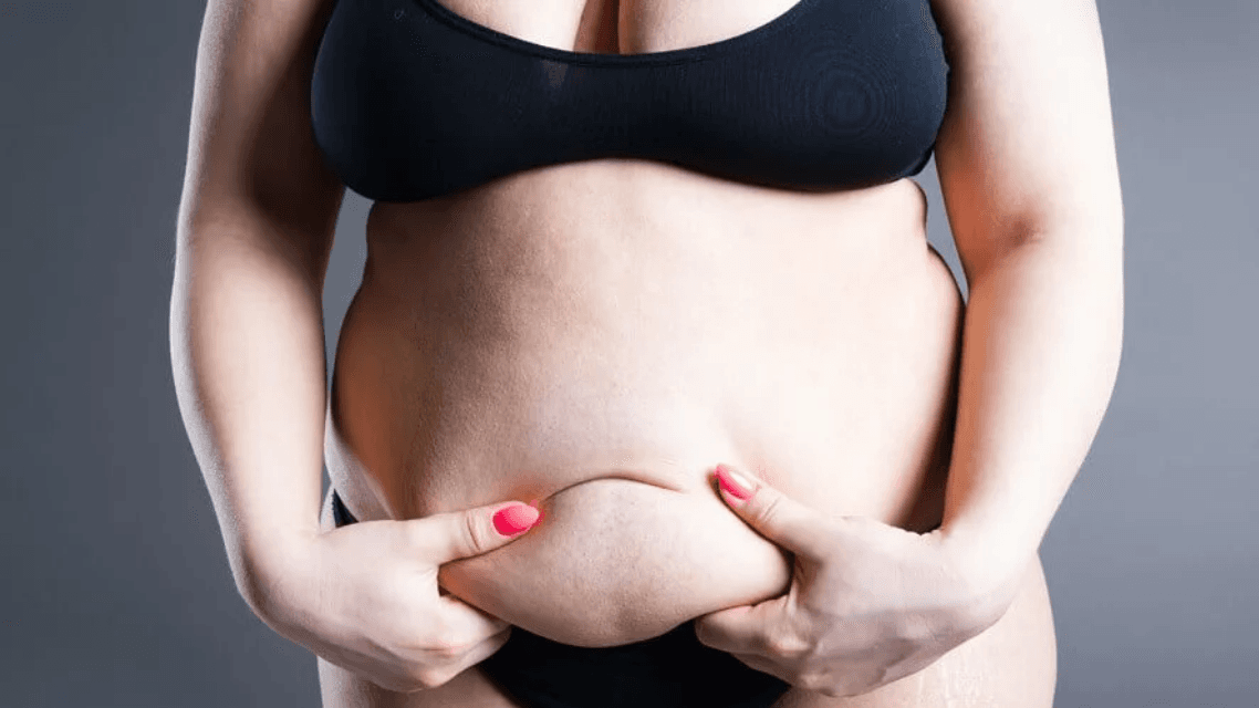 Lipödem bei jungen Frauen: Frühe Warnsignale ernst nehmen