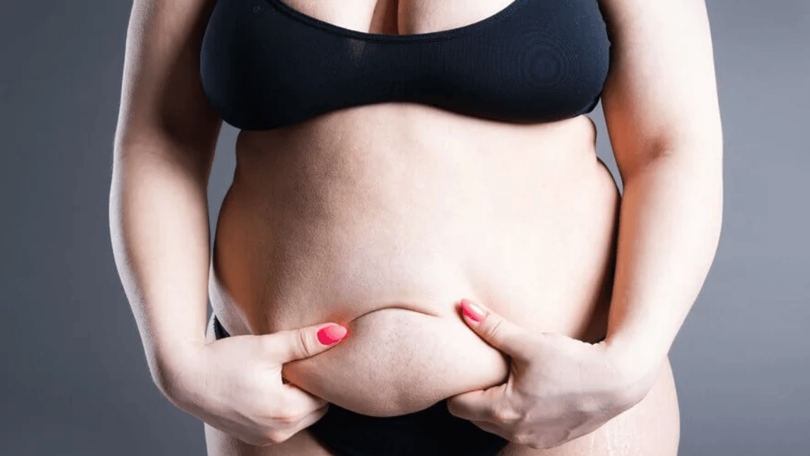 Lipödem bei jungen Frauen: Frühe Warnsignale ernst nehmen
