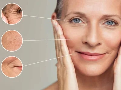Innovative Pflege mit biorepeel behandlung bei MorySkin