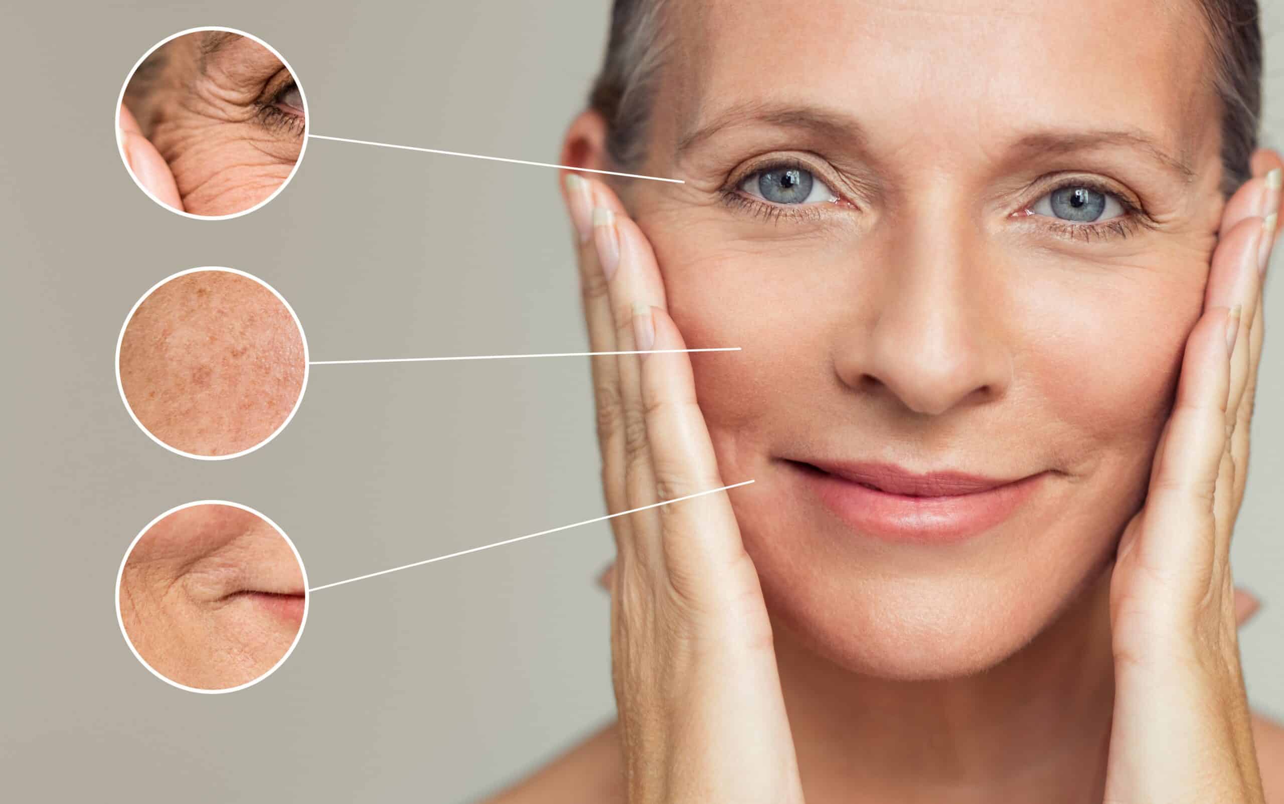 Innovative Pflege mit biorepeel behandlung bei MorySkin